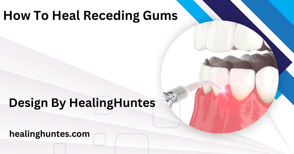 how to heal receding gums