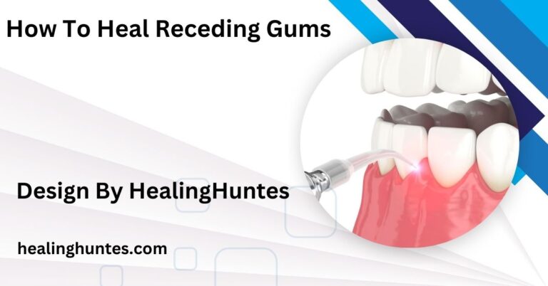 how to heal receding gums