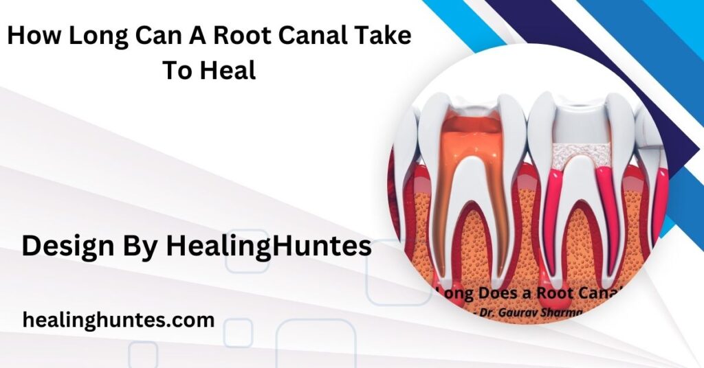 how long can a root canal take to heal