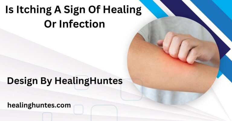 is itching a sign of healing or infection