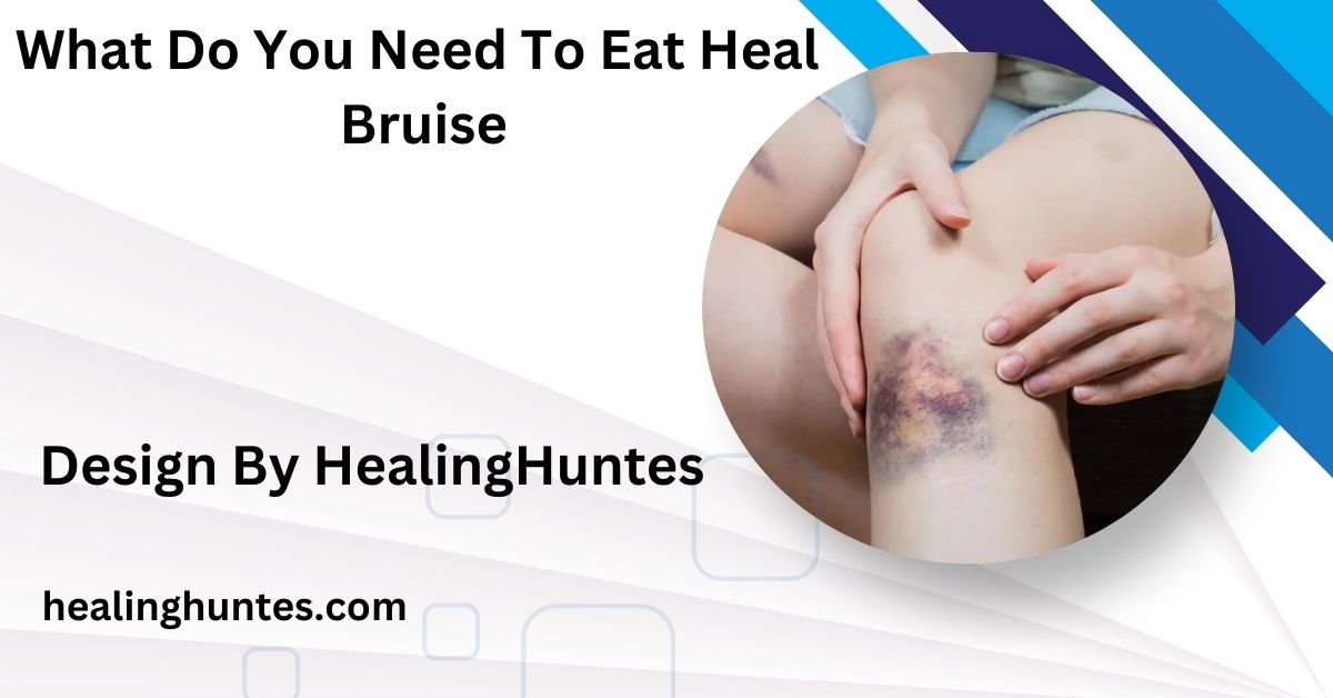 what do you need to eat heal bruise