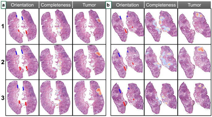 What Is Tissue Margin Separation: