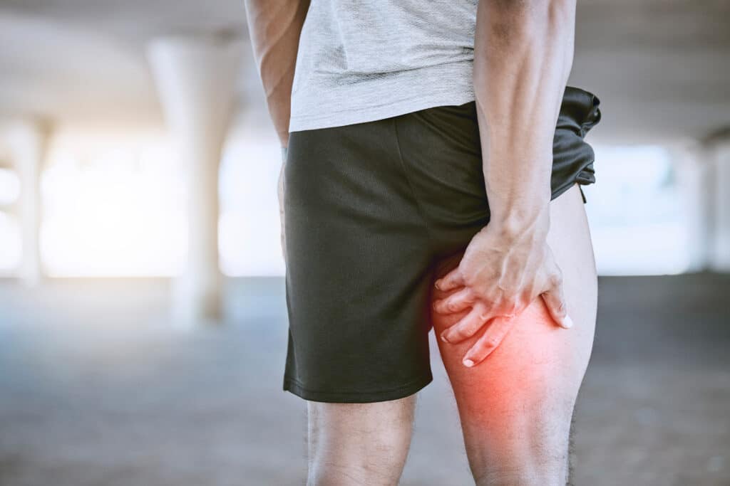 What Is a Hamstring Strain?