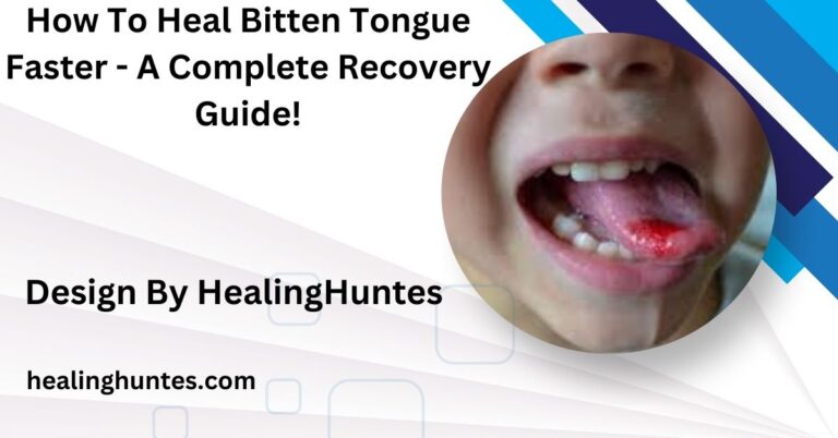 how to heal bitten tongue faster