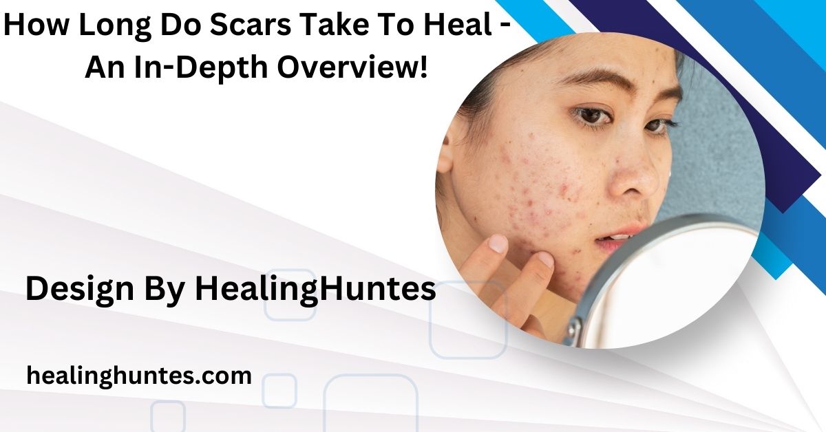 how long do scars take to heal