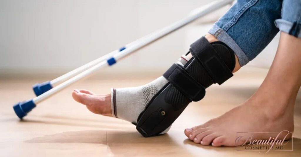 Understanding Ligament Injuries: