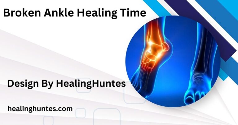 Broken Ankle Healing Time – Factors Affecting Ankle Healing!