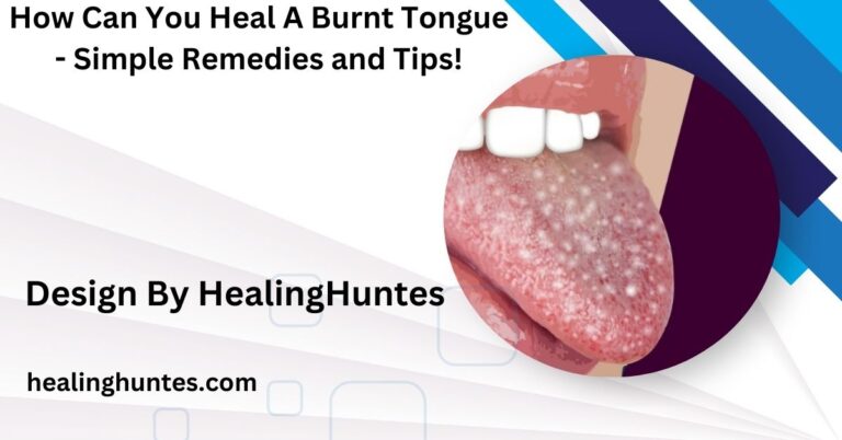 how can you heal a burnt tongue