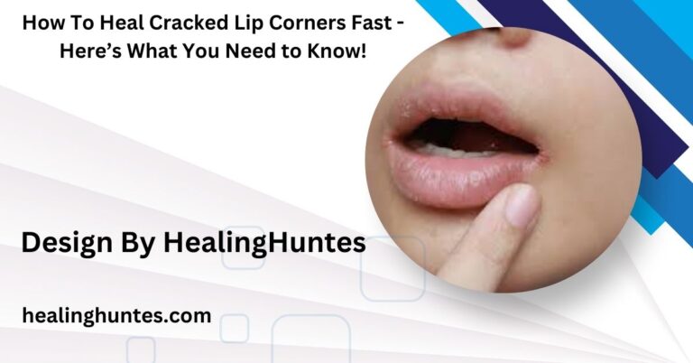 how to heal cracked lip corners fast