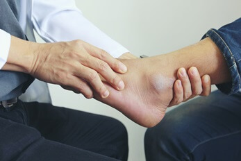 Factors Affecting Time to Heal a Broken Ankle: