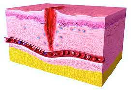 Why Minerals Matter in Wound Healing: