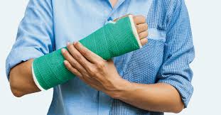 What is a Fractured Hand: