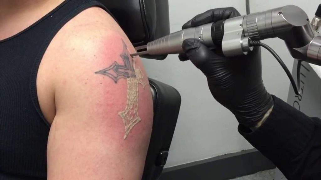 Factors That Affect Tattoo Healing Time: