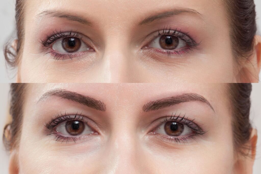 What Is Microblading: