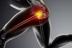 Typical Recovery Time for a Pulled Hamstring: