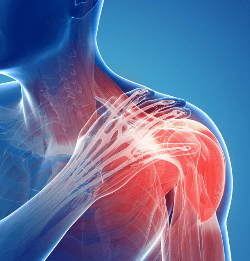 What is a Dislocated Shoulder?