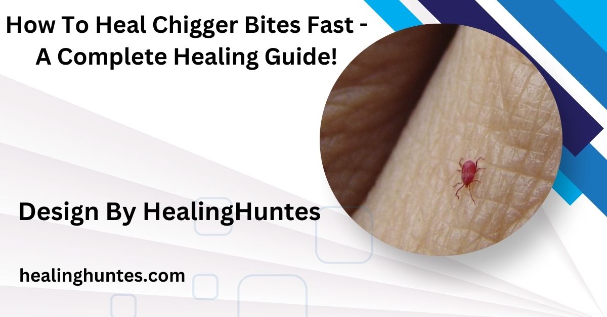 how to heal chigger bites fast