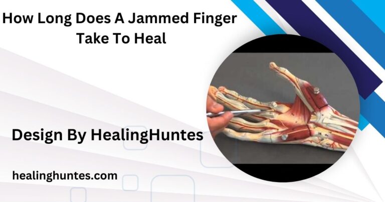 How Long Does A Jammed Finger Take To Heal – Jammed Finger Recovery!