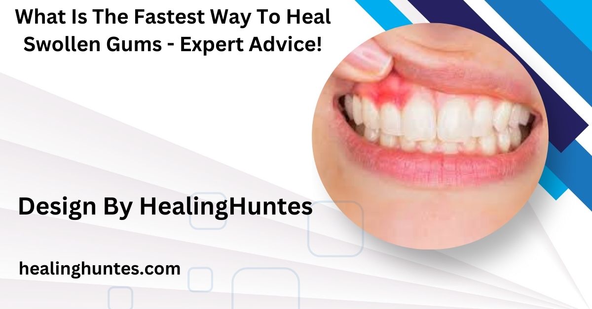 what is the fastest way to heal swollen gums