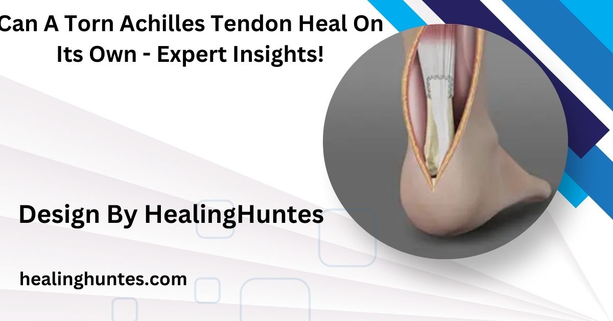 can a torn achilles tendon heal on its own