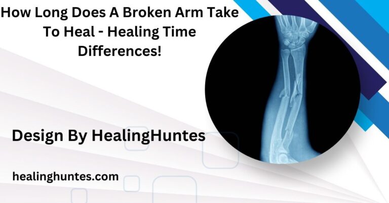 How Long Does A Broken Arm Take To Heal - Healing Time Differences!