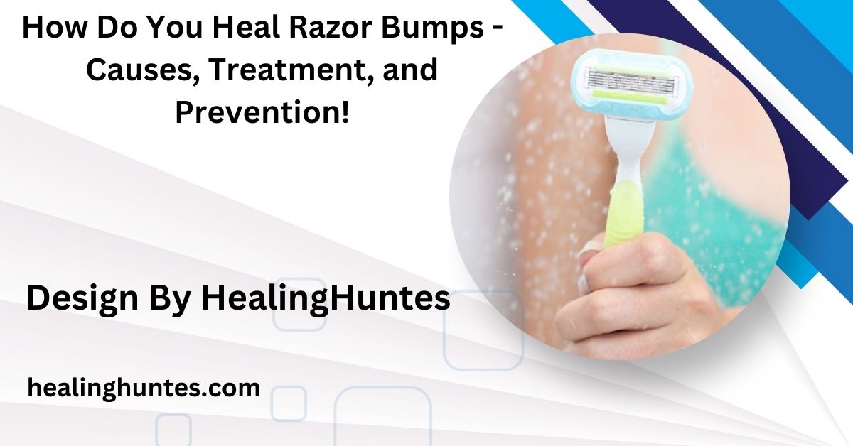 how do you heal razor bumps