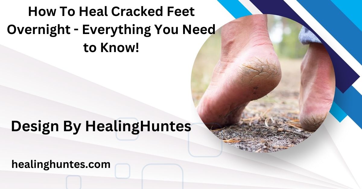 how to heal cracked feet overnight