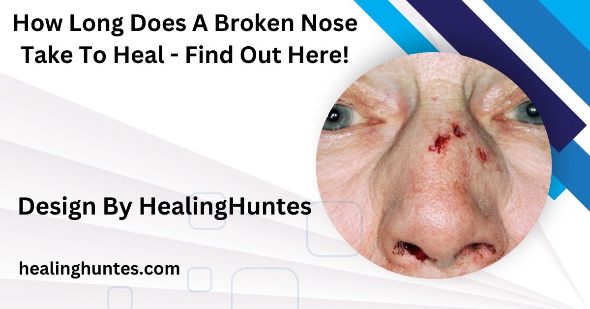 how long does a broken nose take to heal