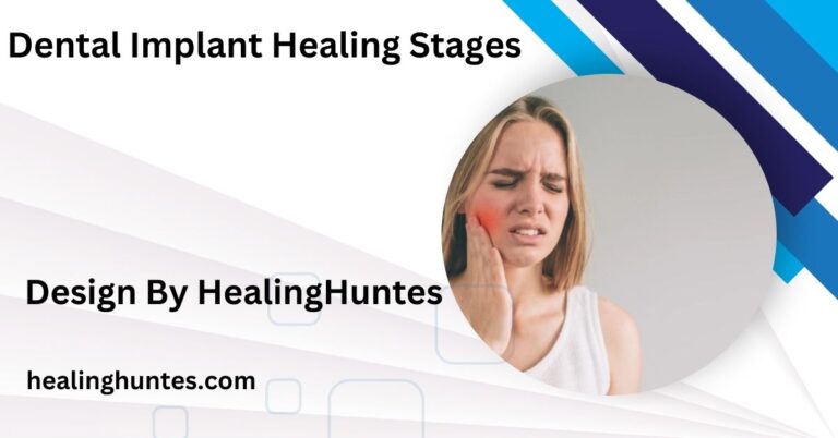 Dental Implant Healing Stages