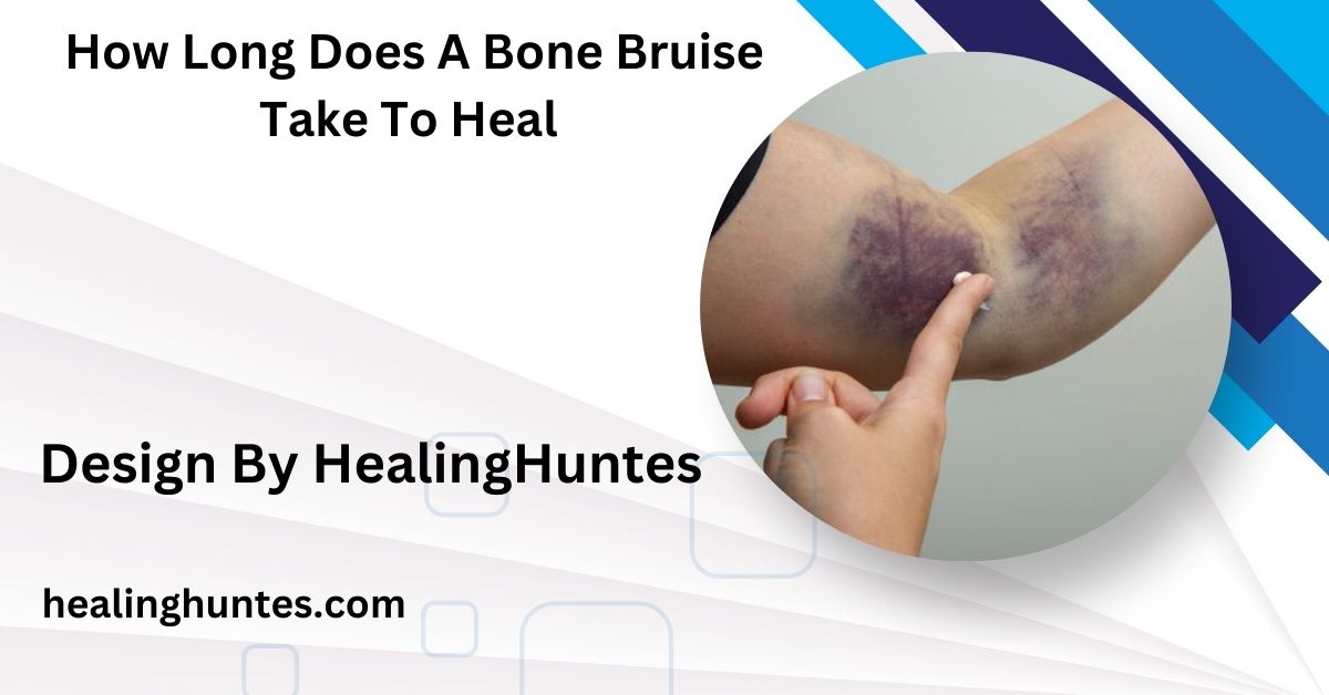 How Long Does A Bone Bruise Take To Heal - Symptoms, Recovery Time, and Care!