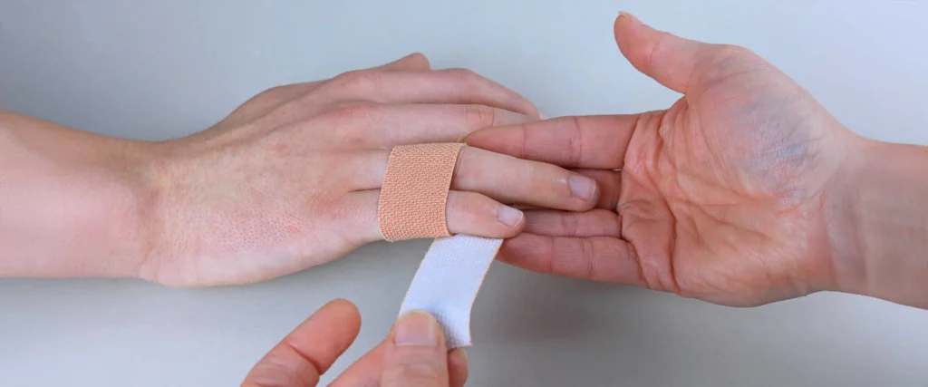 Treatment Options for Jammed Fingers: