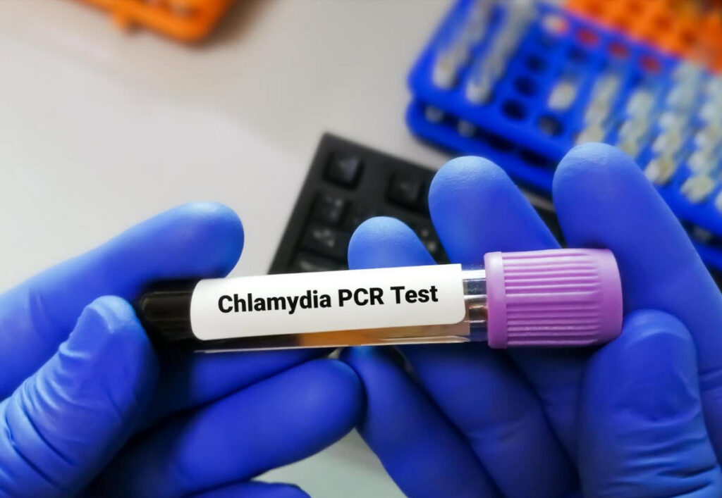 How would you explain Chlamydia in simple terms: