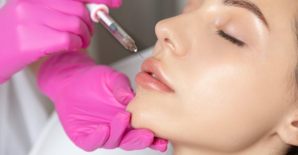 What Are Lip Fillers: