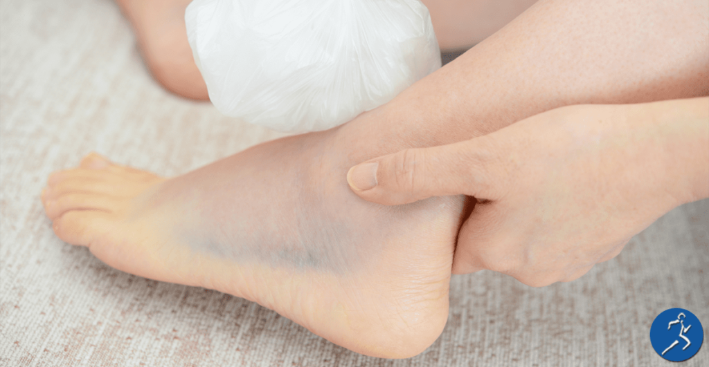 Understanding a Sprained Foot: