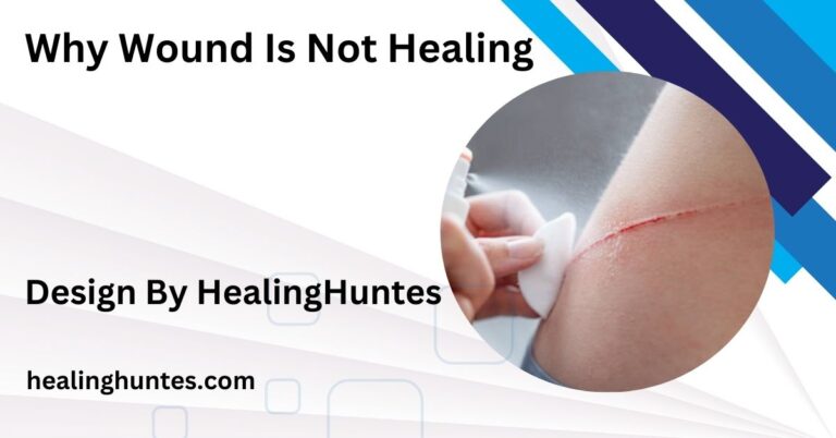 Why Wound Is Not Healing